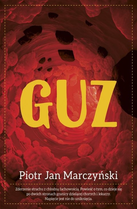 Guz Guz