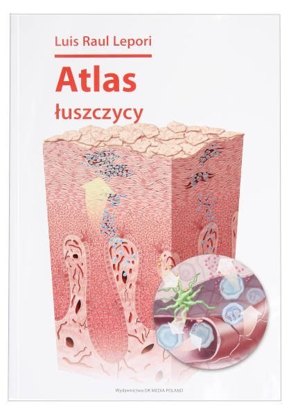 Atlas łuszczycy Atlas łuszczycy