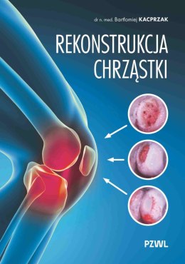 Rekonstrukcja chrząstki. Ratujemy kolano, nie wymieniamy